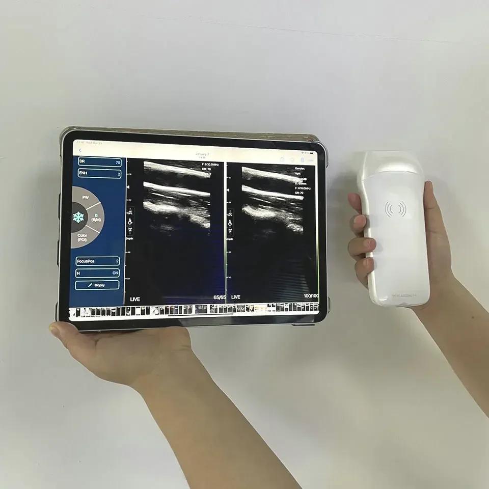 Карманный мини-приемник Goedkope для Android Easi Scan 128 элементный Wi-Fi B Draagbare Draadloze Ultrasone