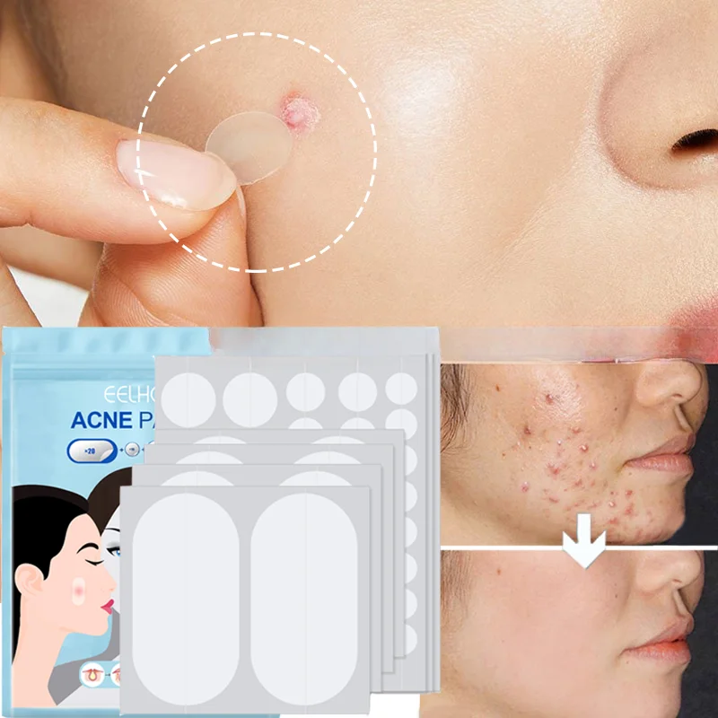 

Invisible Acne Sticker Treatment Patch Waterproof Facial Skin Care