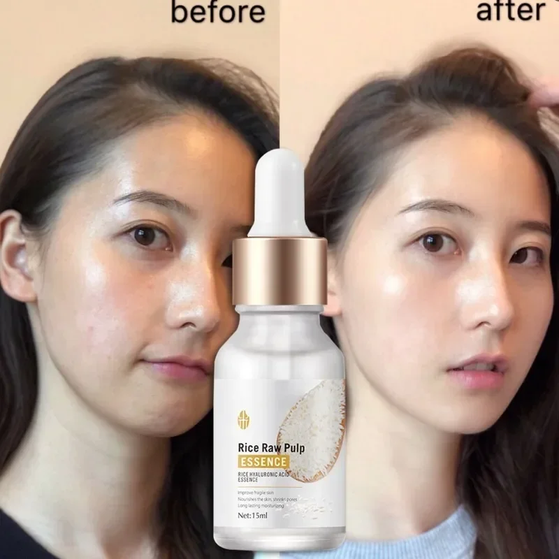 Отбеливающая Сыворотка с гиалуроновой кислотой глубокое увлажнение уменьшение