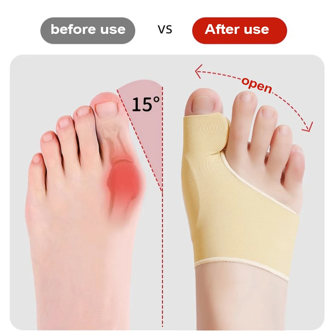 Рисунок 3 - Разделитель для пальцев ноги при