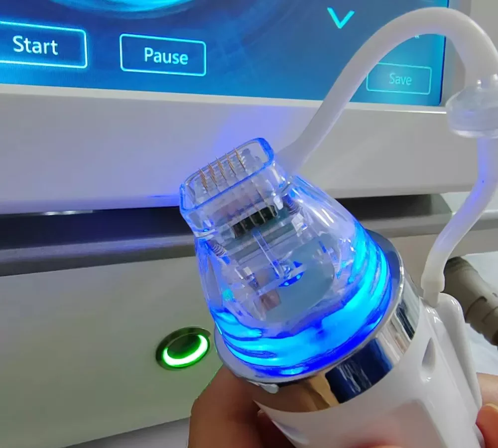 

NEW IN 10/25/64/nano tip The disposable micro needle cylinder is gold-plated for anti acne stretch marks with micro needle radio