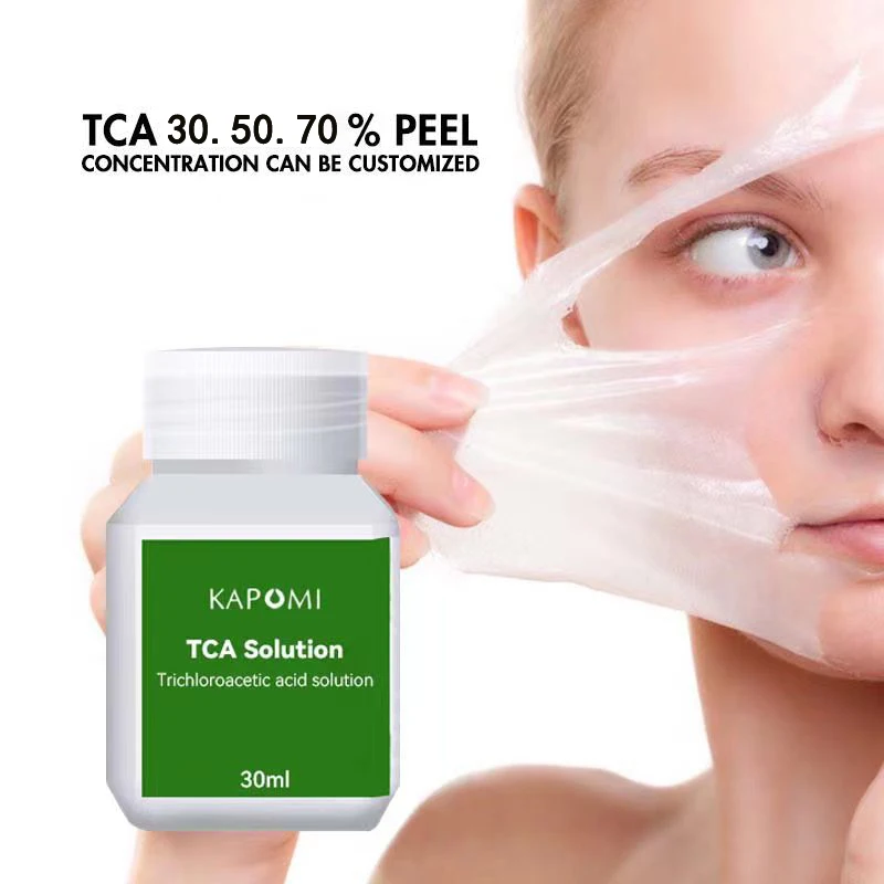 

30% 50% 70% Tca Cross Peel Peeling Acid Skin Super Force Yellow Peeling Oil Pigmentation Acne Scar Skin Care