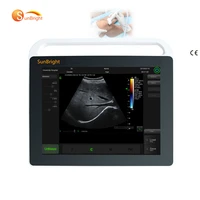 best quality standard ophthalmic ultrasound instruments machine b ultrasound machine cavitation scanner