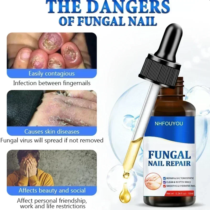ГОРЯЧАЯ ПРОДАЖА сыворотка для лечения грибка ногтей средства ремонта пальцев