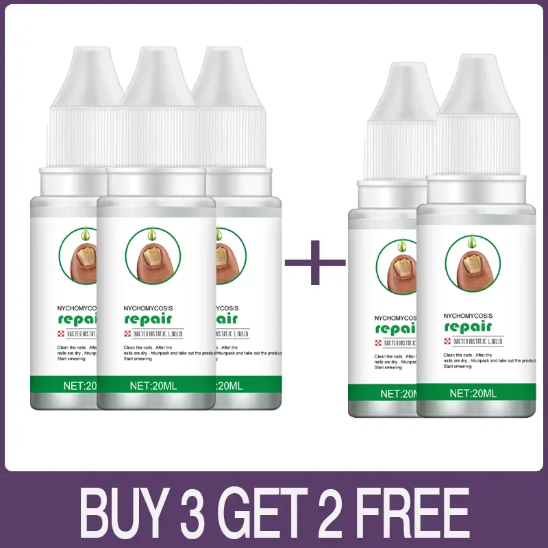 

Профессиональная пластиковая очистка для линз