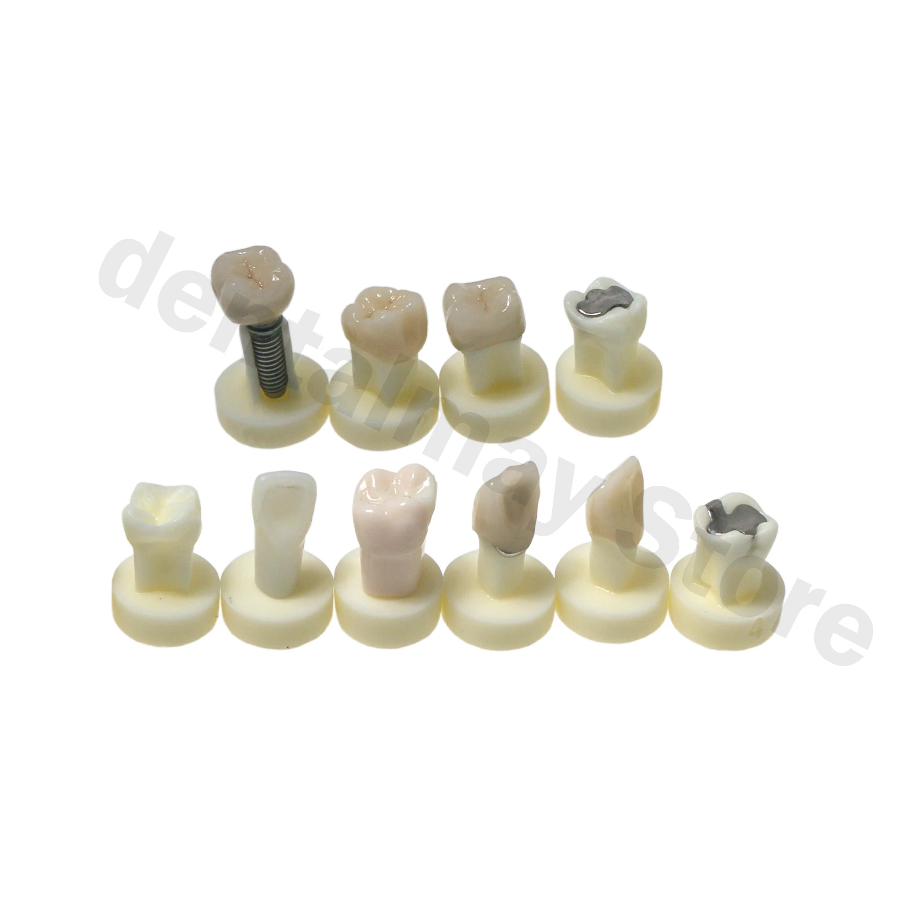 Стоматологическая керамическая модель короны 10*1 для демонстрации и сравнения