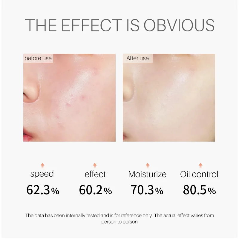 Натуральное масло чайного дерева увлажняющее средство для ухода за волосами