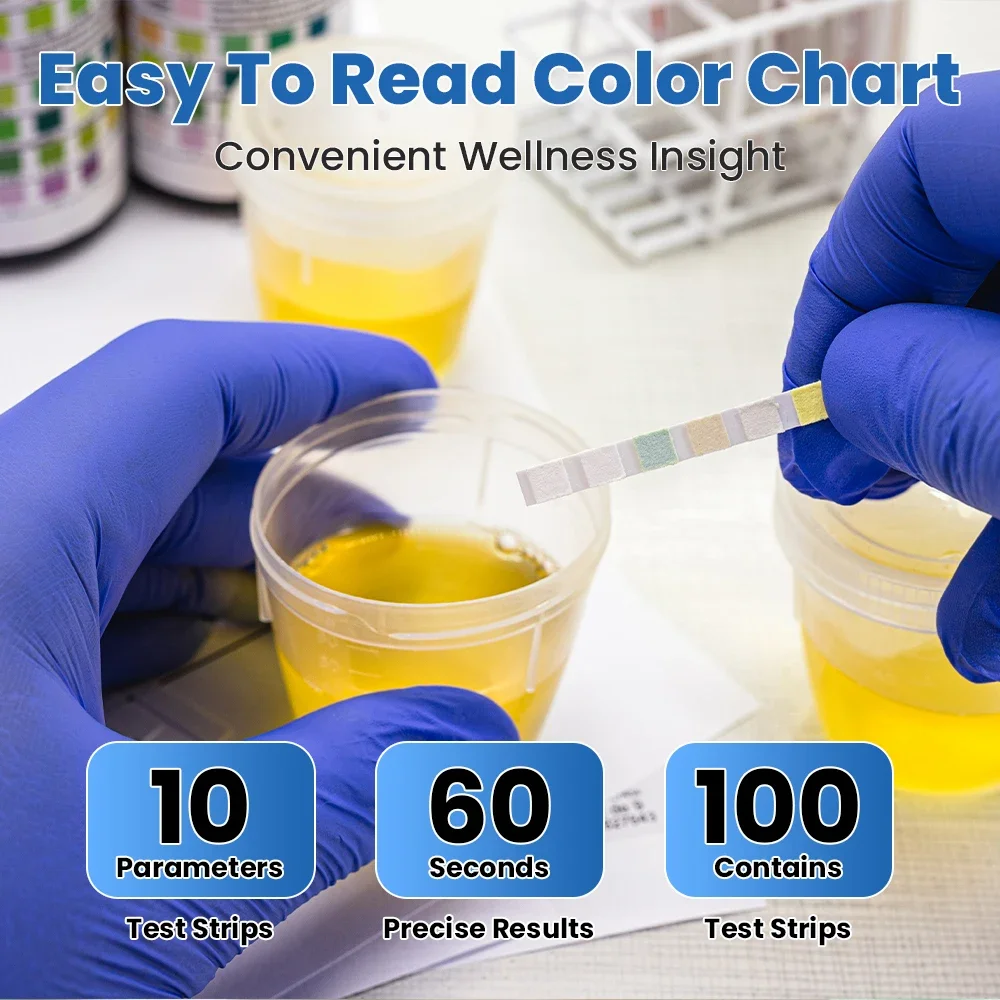 10-параметрические тест-полоски URS-10T для W-200B/W-600/IU-100