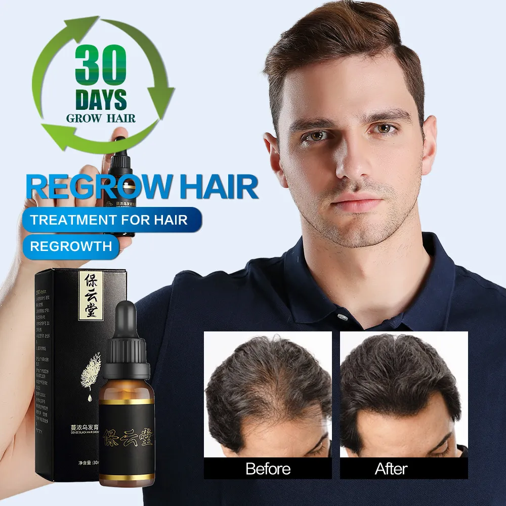 Fast Hair Growth Essence Anti Hair Loss Controls Hairfall Penetrates Deep Into Hair Root To Promote Hair Regeneration 30ML