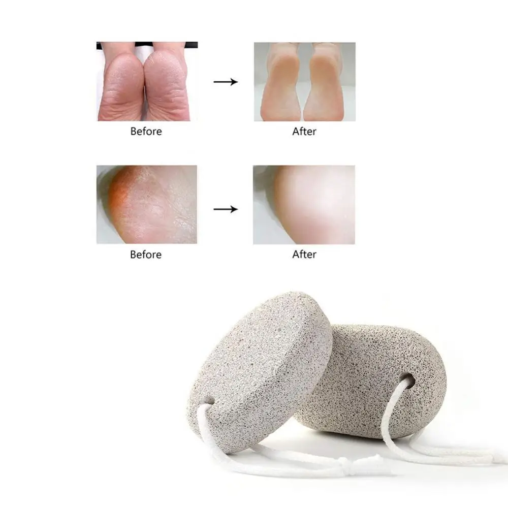 Hot Sale Oval Pumice Stone Foot Grinder Death Hard Skin Callus Remover Feet Pedicure Tool | Care