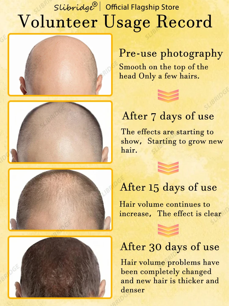 98% покупателей покупают снова у них все больше волос попрощайтесь с облысением