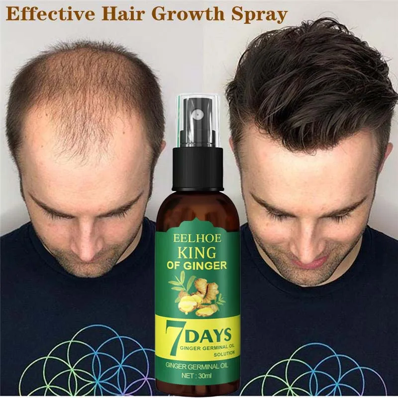 

7 Days Ginger Hair Growth Spray Oil Men Women Fast Promote Hair Grow Thicker Anti Hair Loss Scalp Treatment Nourish Hair 30/50ml
