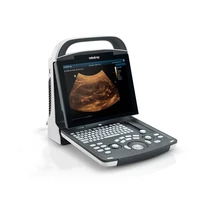 mindray portable black white ultrasound machine dp 10