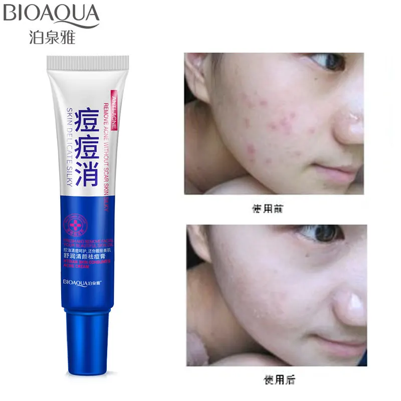 

BIOAQUA Acne Treatment Cream Anti Acne Scar Removal Gel Whitening Moisturizing Shrink Pores Beauty Essentials for Face Skin Care
