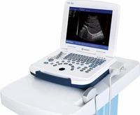 hot selling portable diagnostic sonography ultrasonography ultrasound scanner portable handheld laptop ultrasound