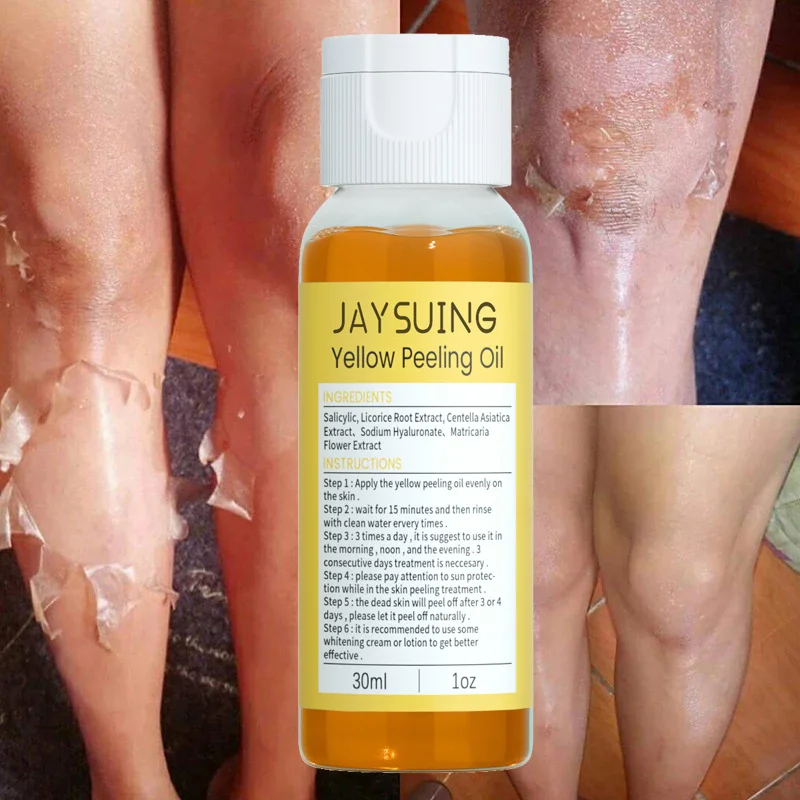 

Yellow Peeling Oil Body Exfoliation Bleaching Serum Dark Skin Remove Melanin Arm Knee Legs Whitening Brighten Beauty Skin Care