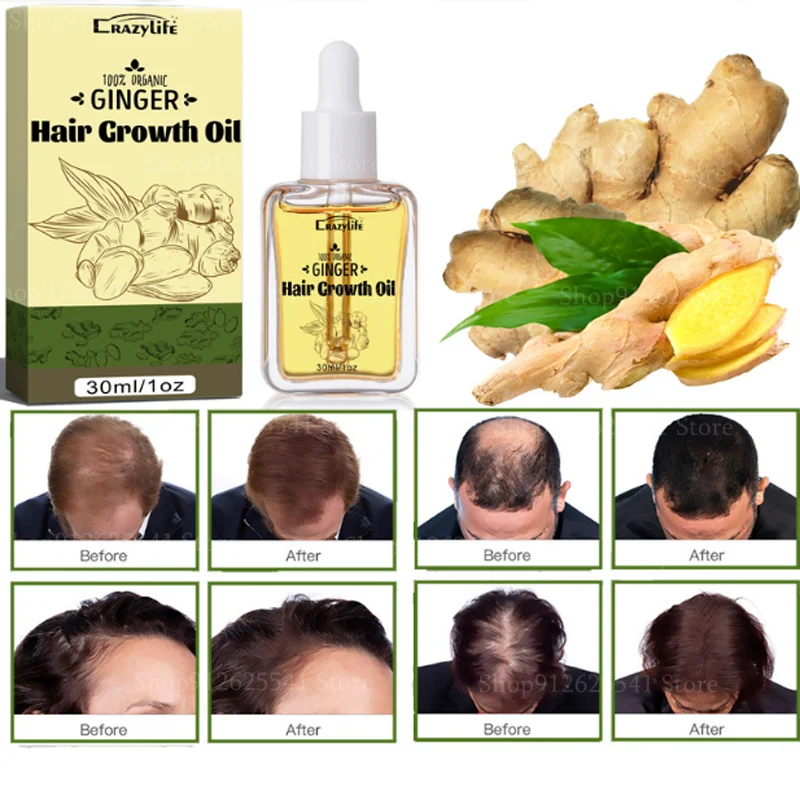 

30ml Natural Ginger Hair Care Essential Oil Improves Frizz and Strong Hair Hair Growth Anti Hair Fall Oil Treatment Serum Care