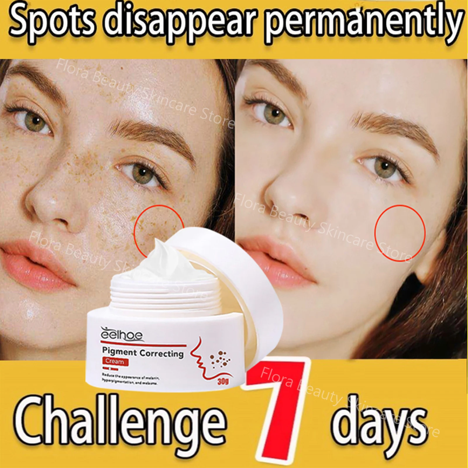 Powerful Whitening Freckle Cream Remove Dark Spots Melanin Melasma Face Firming Anti-Aging Brighten Moisturizer Beauty Skin Care