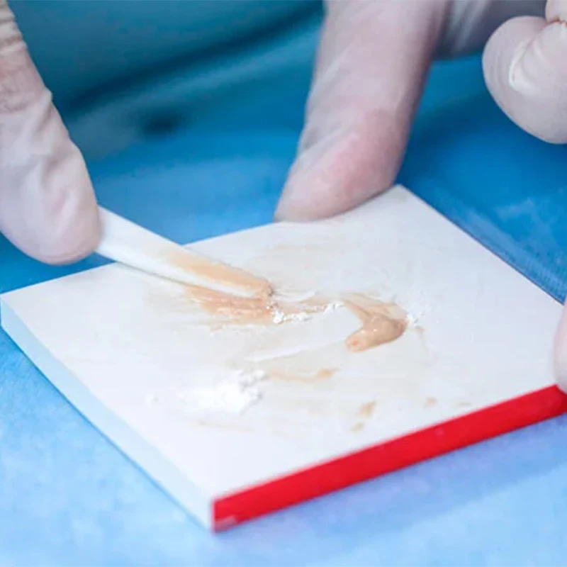 VVDental стоматологический стеклянный линометр цементная начинка I стеклоионная