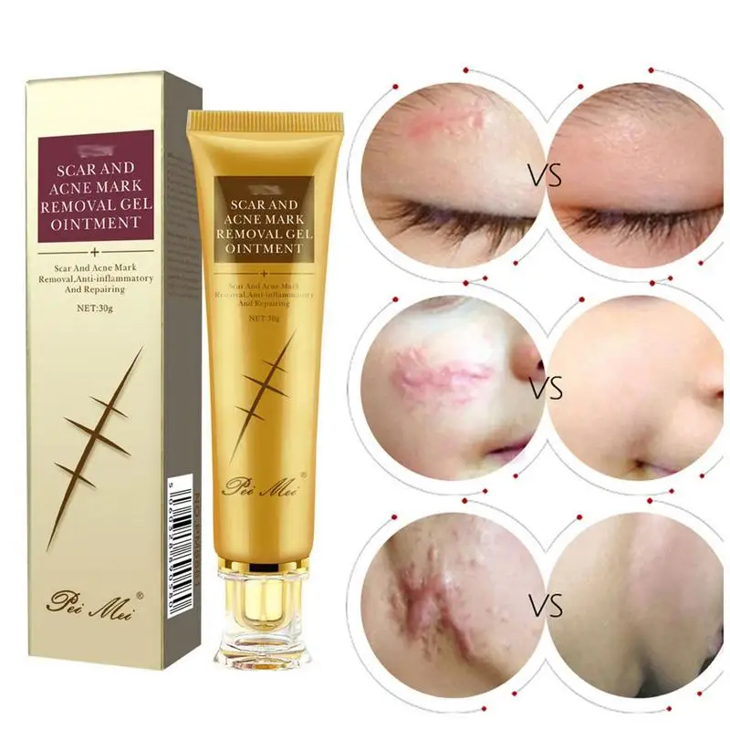 

1.05 Oz Scar Removal Natural Scars Removal Cream Moisturizing Scar Gel Cream For Women And Men Rapid Repair Of New Old Scars