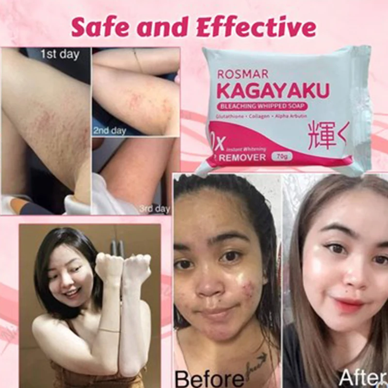 

Мыло Rosmar Kagayaku для отбеливания, 70 г, для лица и тела