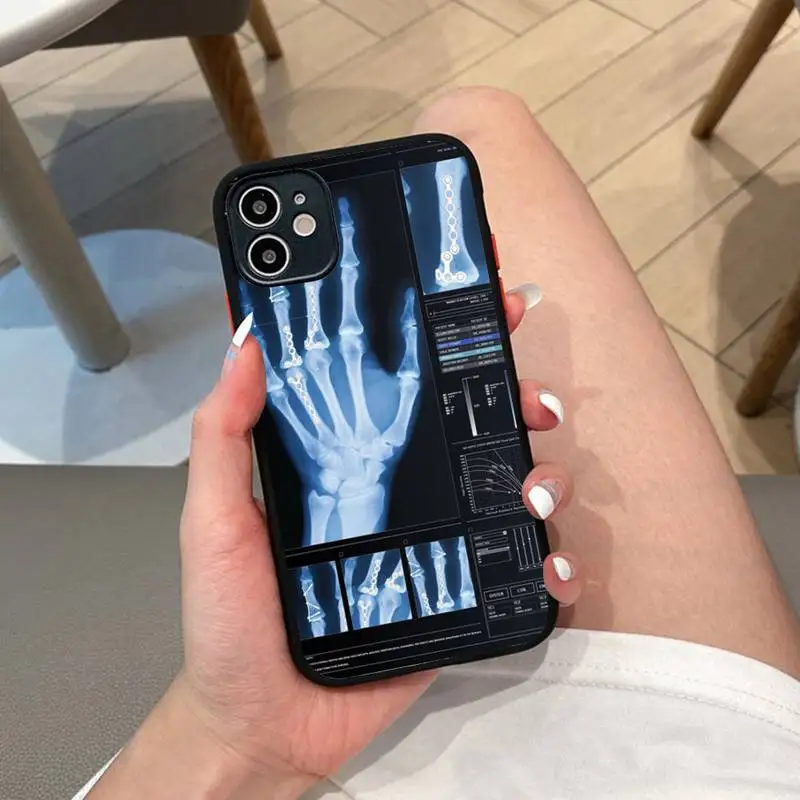 

Radiological human organs Skeleton skull Phone Case for iPhone 14 11 12 13 Mini Pro Max 8 7 Plus X XR XS MAX Translucent Matte