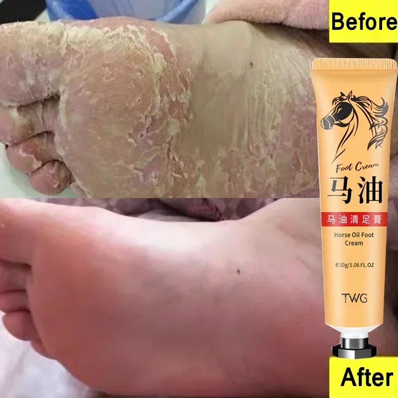 Крем для ног с конским маслом увлажняет кожу от грибков восстанавливает