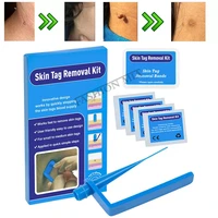home use skin tags remover kit remove warts body skin care tools wart treatment face skin tag removal tool acne tag remover band