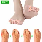 1 пара, выпрямитель для большого пальца ноги при вальгусной деформации