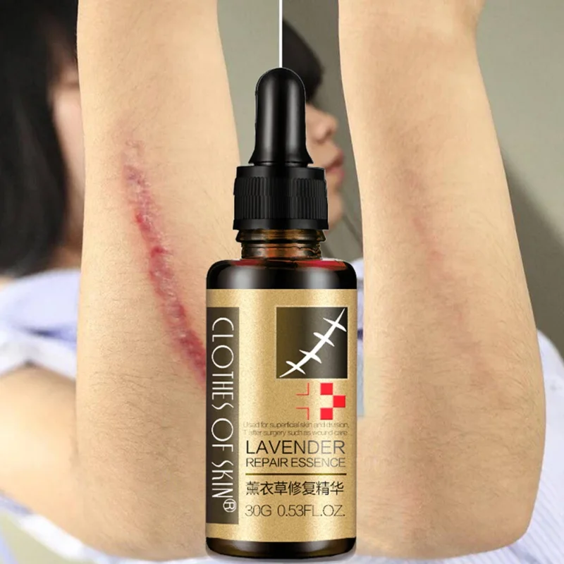 

2022 New Lavender Essence Scar Repair Skin Essential Oil Natural Pure Remove Ance Burn Strentch Marks Scar Removal 30ml