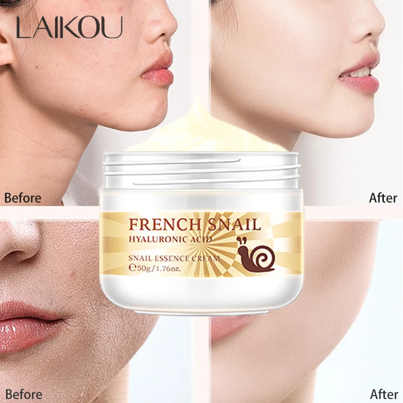 Snail Face Cream Improve Dry Rough Skin Anti-Wrinkle Whitening Facial Hyaluronic Acid Moisturizing Nourishing Serum Skin Care