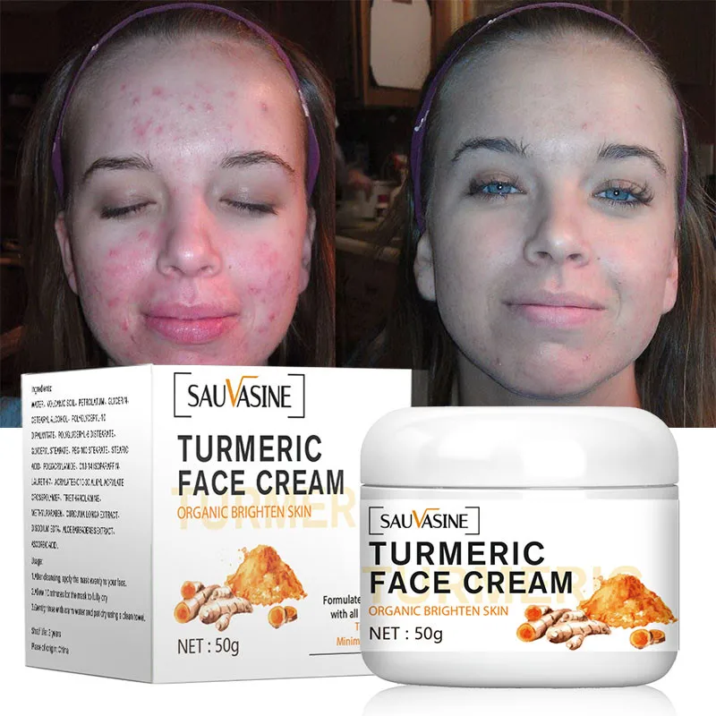 

Turmeric Face Whitening Brighten Cream Repair Acne Lighten Dark Spots Facial Serum Anti-Aging Fade Dark Skin Moisturizer Cream