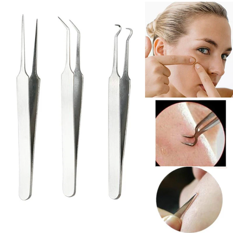 

3 Pcs/lot Blackhead Remover Clamp Acne Blemish Pimple Extractor Remover Needles Stainless Steel Blackhead Acne Clip Tweezer Tool