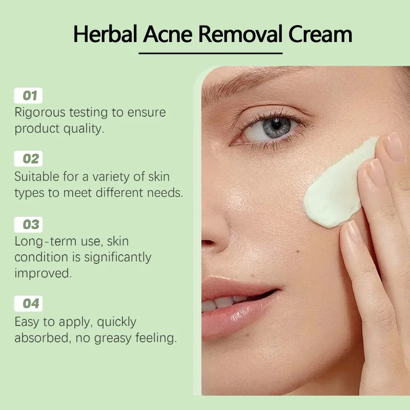 Травяной крем для лица удаления прыщей удаление следов от контроль жирности