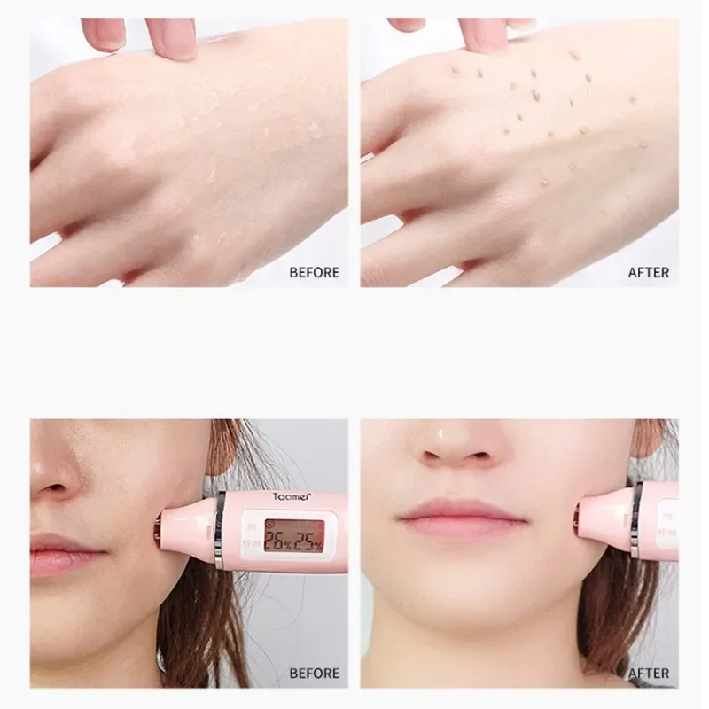 Эффективный Отшелушивающий гель для лица с алоэ увлажняет глубокое очищение