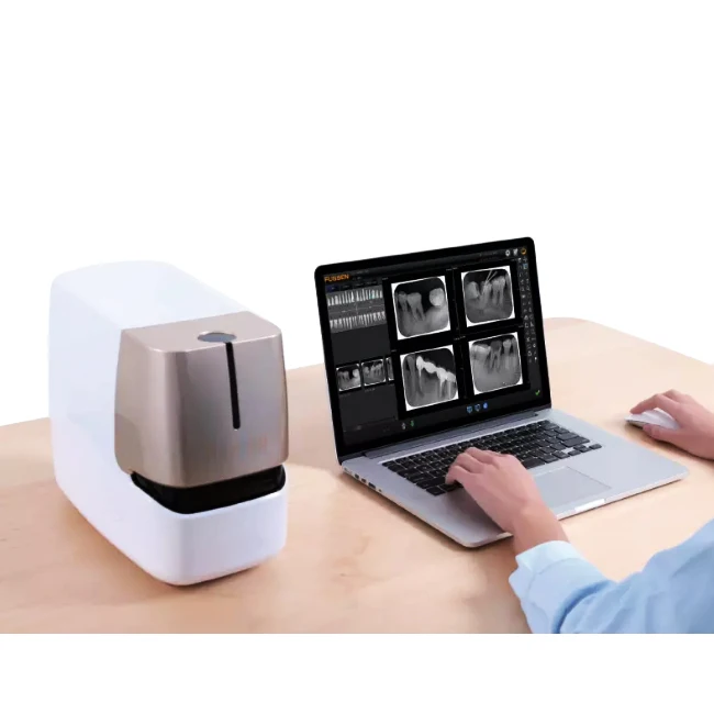medical device rayos x portatil portable intraoral equipment x-ray film