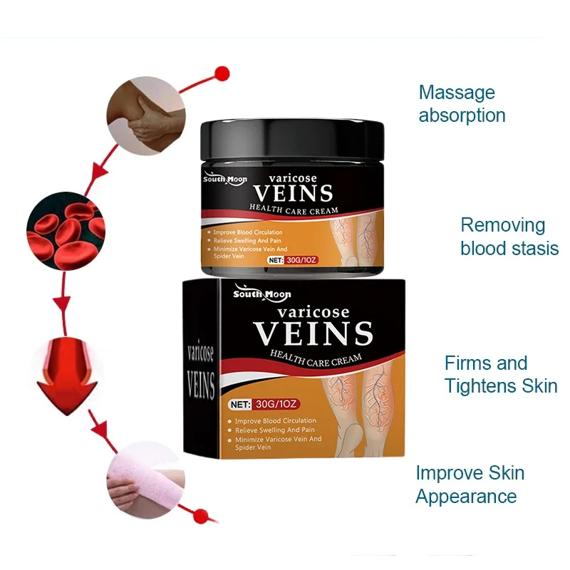 Крем для лечения варикозного расширения вен восстанавливает боль в ногах