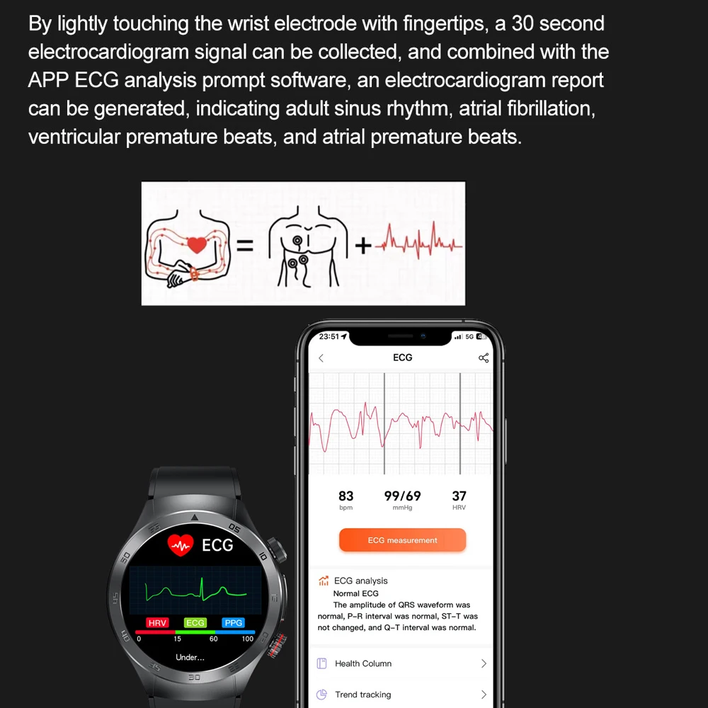 Смарт-часы AMOLED 1 49 дюйма ЭКГ PPG HRV Bluetooth