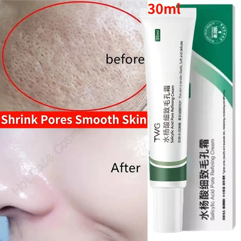 Средство для сужения пор с салициловой кислотой крем очищения удаление черных