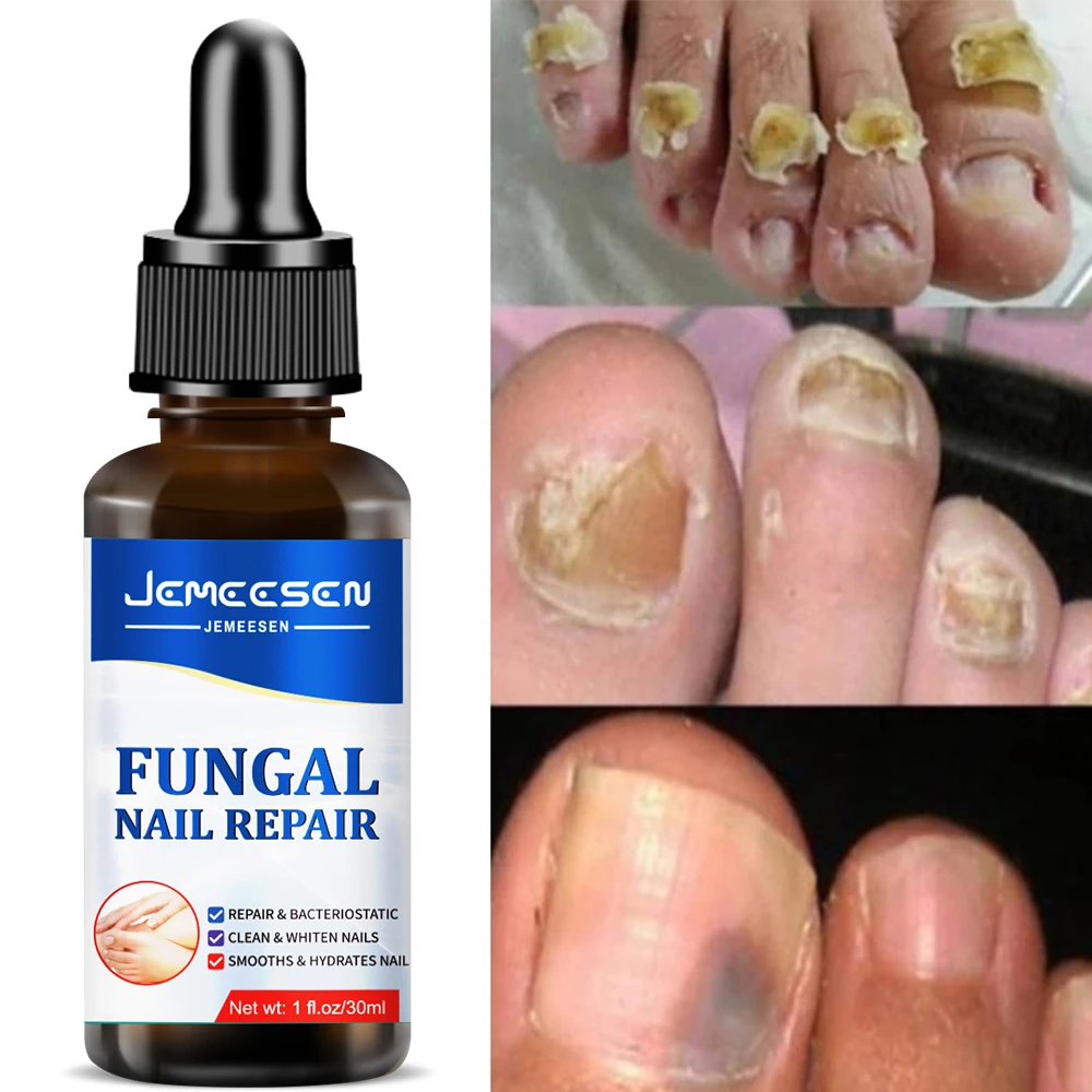 

Сыворотка с экстрактом от грибка ногтей, 30 мл