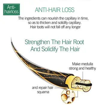 20ml Hair Care Hair Growth Essence Anti-fall Hair Loss Liquid Health Care Beauty Dense Hair Growth Nourishing Serum 3