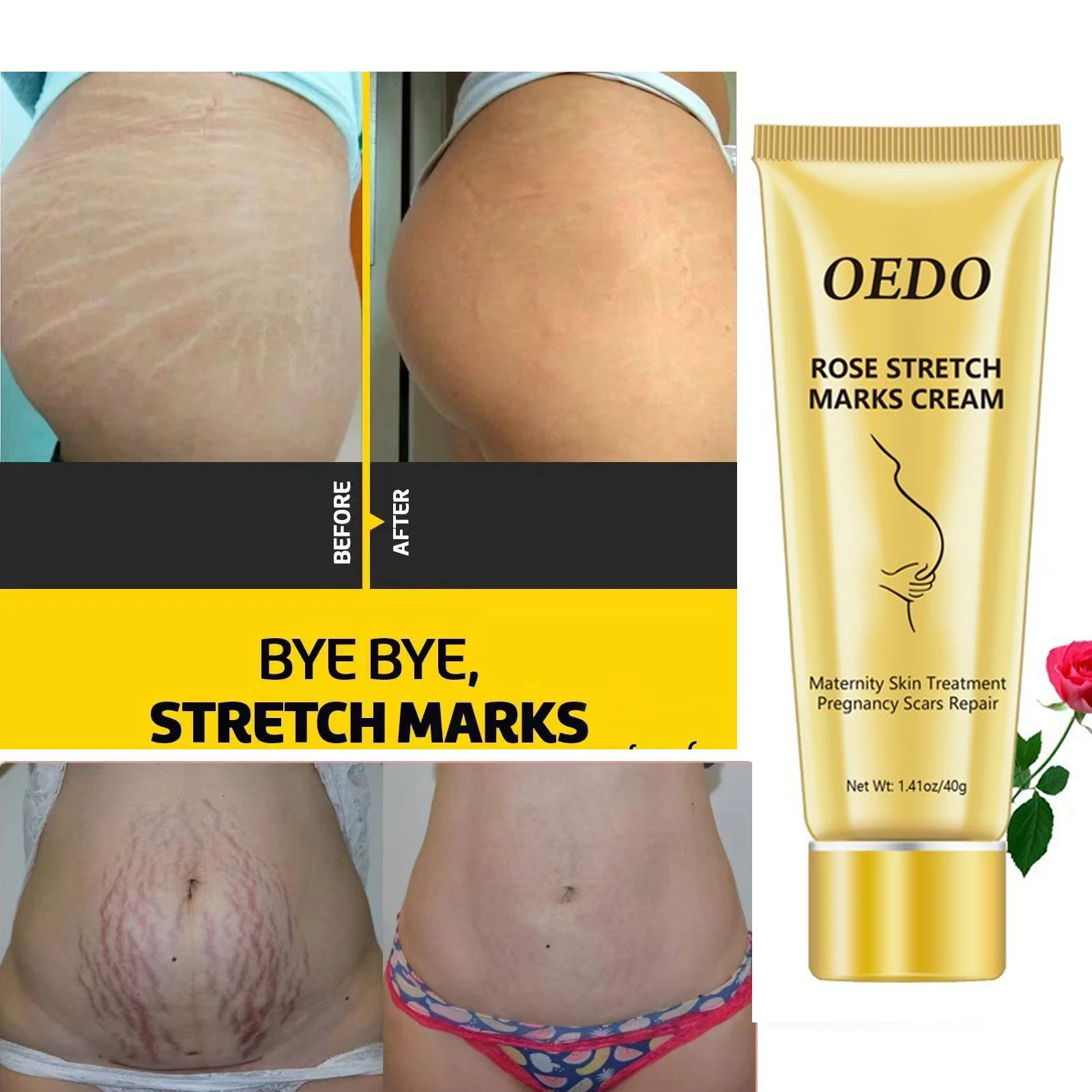 

OEDO Rose Remove Stretch Marks Cream Maternity Body care Stretch marks Removal Scar treatment Anti-aging Anti-wrinkle Skin care