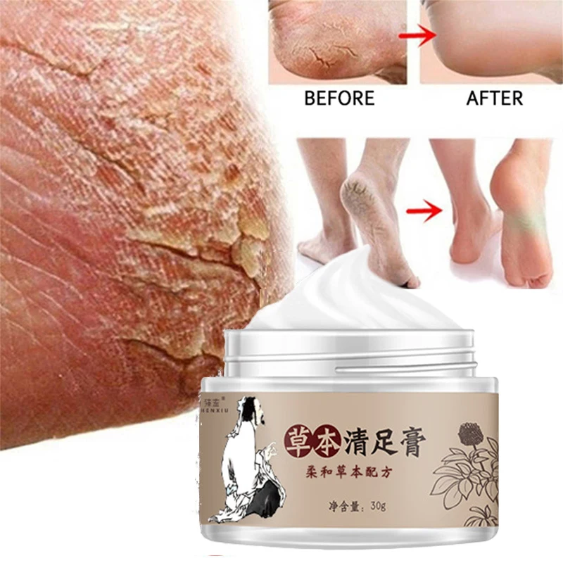 

Anti Crack Foot Cream Feet Peel Mask Heel Cracked Dry Repair Creams Hand Peeling Removal Callus Dead Skin Care Products 30ml