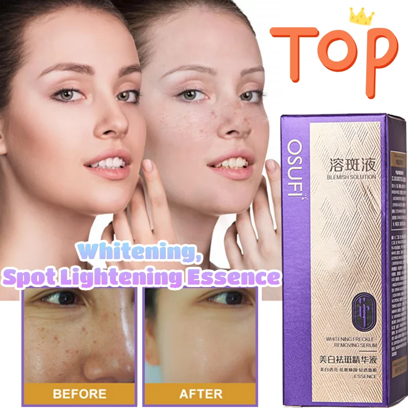 

Whitening Freckle-removing Essence Lightens Melanin Spots, Moisturizes, Brightens Skin Tone Freckle-dissolving Liquid Skin Care