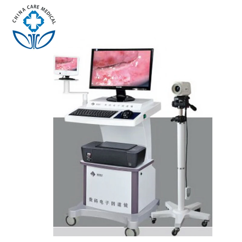 

Portable Electronic Mini Cervical Video Colposcopy Colposcope Culposcope Camera Machine Equipment For Gynecology In China