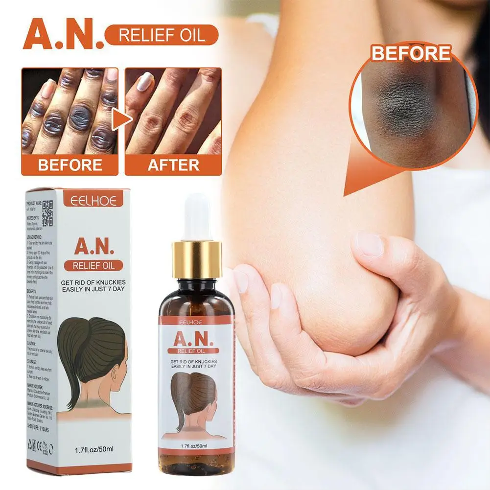 

50ml Acanthosis Nigricans Therapy Oil Dark Spot Corrector Oil Dark Knuckle Whitening Serum For Removing Dark Knuckle Joint Elbow