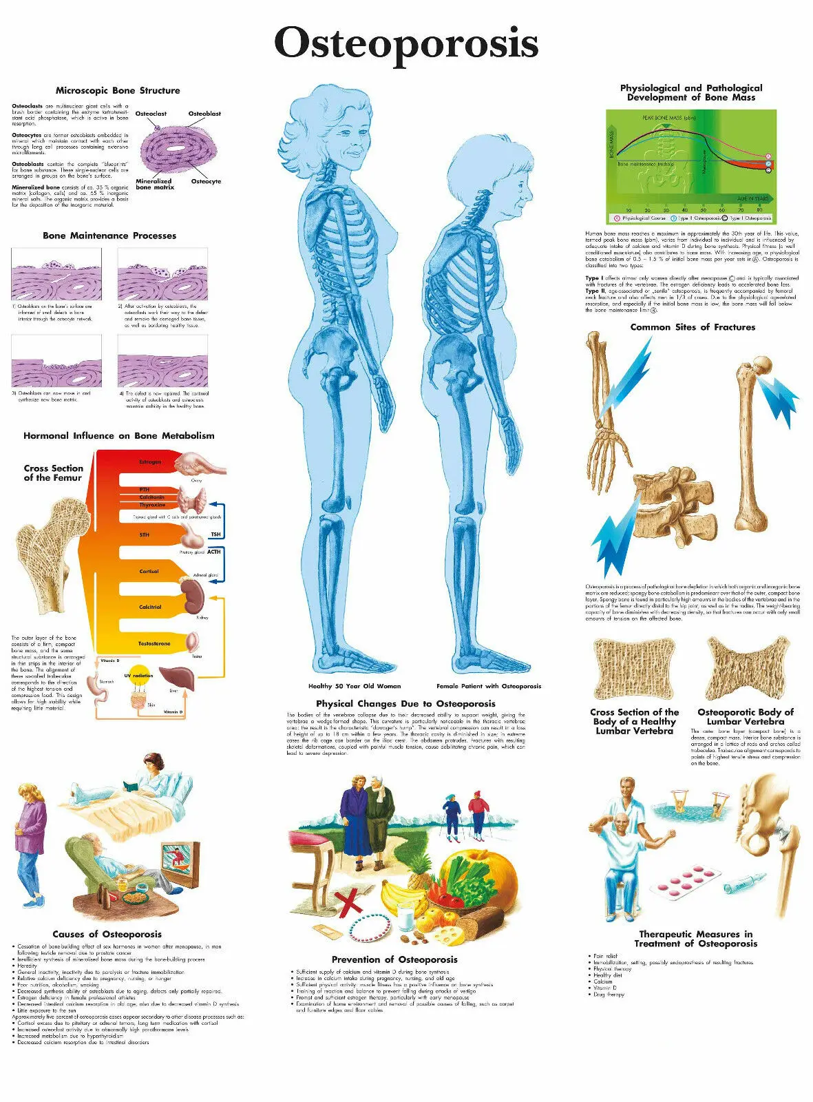 

Шелковый постер с рисунком остеопороза, домашний Настенный декор