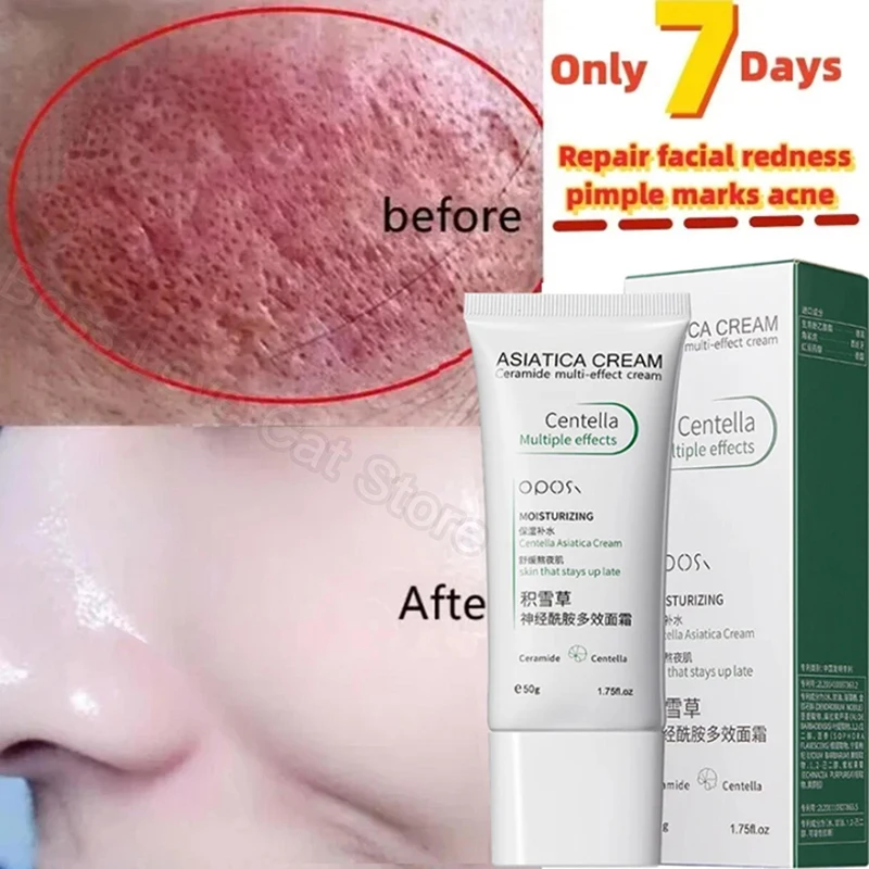 Крем для покраснения кожи лица быстрое восстановление сужение зуда