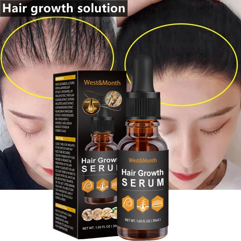

Women Hair Growth Products Anti Hair Loss Fast Growing Hair Care Essential Oils Men Prevent Hair Loss Scalp Treatment 30ML