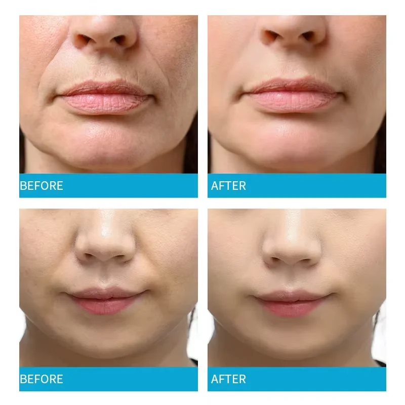 Коллагеновая маска для лица пластырь удаления морщин твердый лифтинг провисание